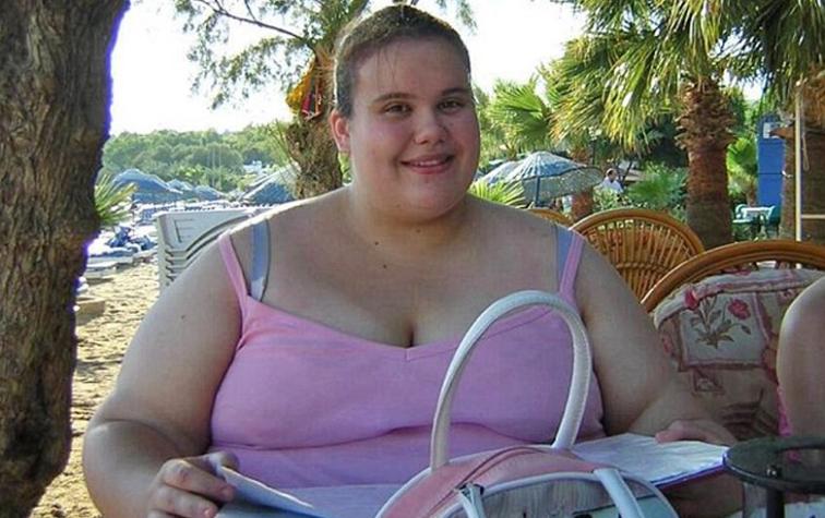 Mujer escocesa pasó de la obesidad a la anorexia