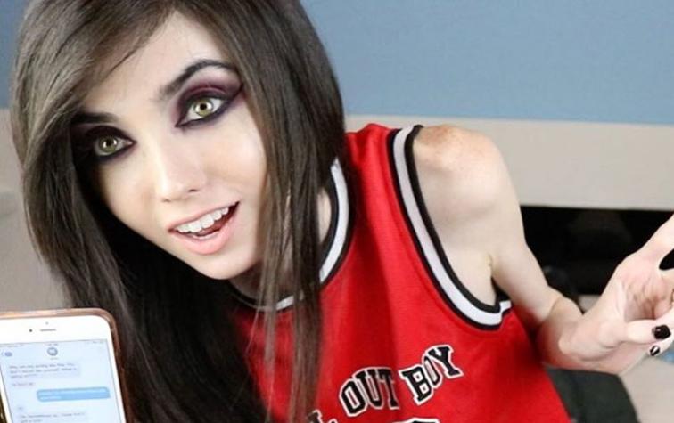 Piden cerrar canal de YouTube de joven que pesa 27 kilos