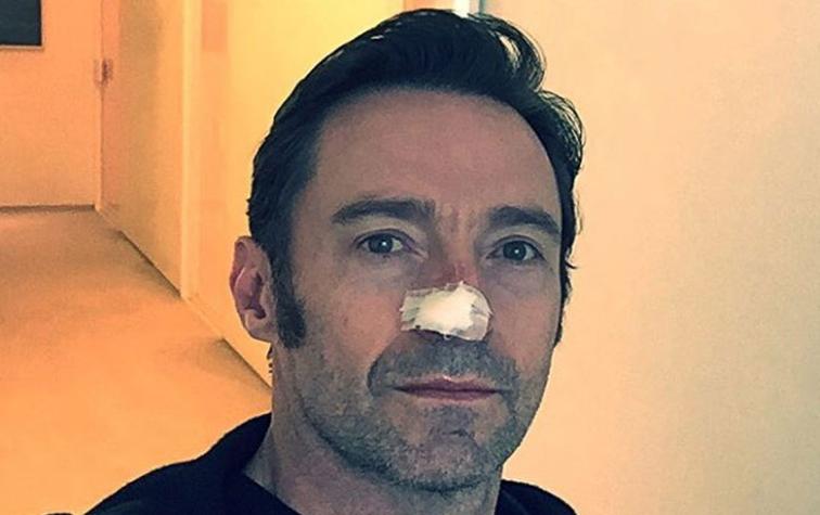 Hugh Jackman se sometió por sexta vez a operación de cáncer de piel