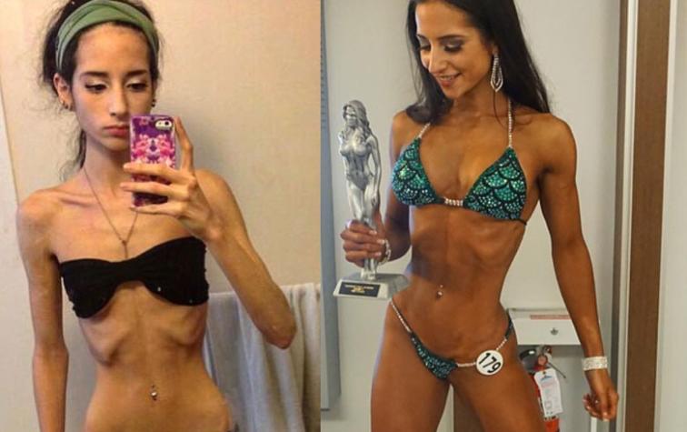 Sarah venció la anorexia y hoy es fisicoculturista