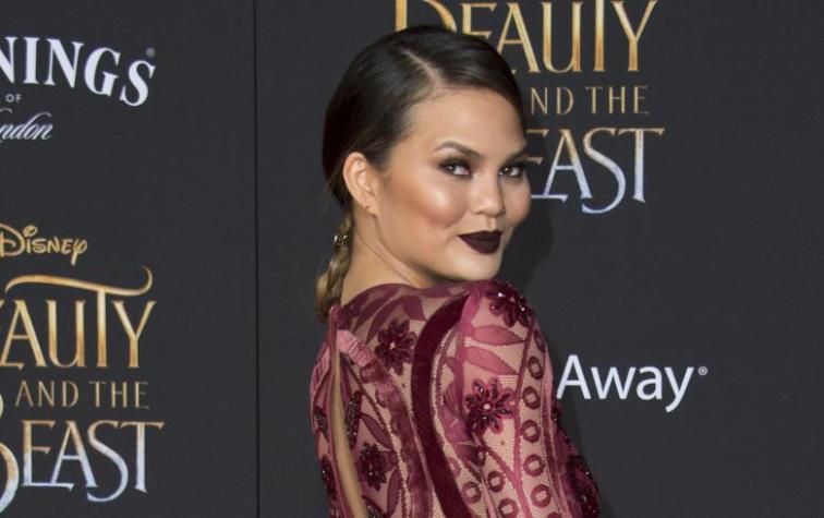 Chrissy Teigen revela todas sus cirugías: “Todo lo mío es falso”