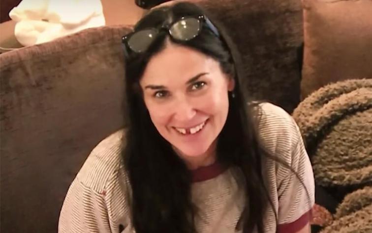 Demi Moore perdió los dos dientes delanteros debido al estrés