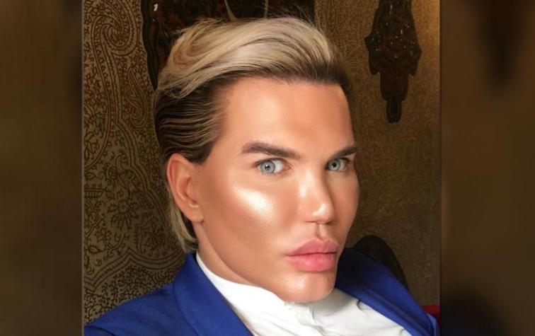 Ken humano se somete a tratamiento de belleza y ahora lucha contra el desastroso resultado