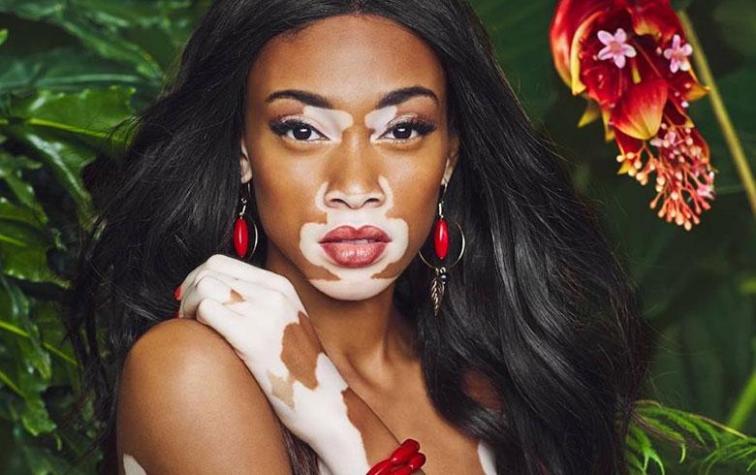 Con chaleco llegó Winnie Harlow a la gala de los British Fashion Awards 