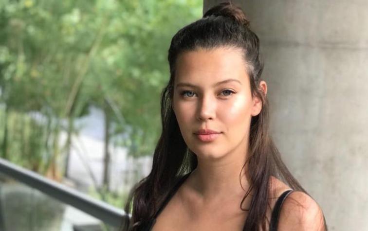 Tratamiento capilar está dejando sin pelo a Michelle Carvalho 