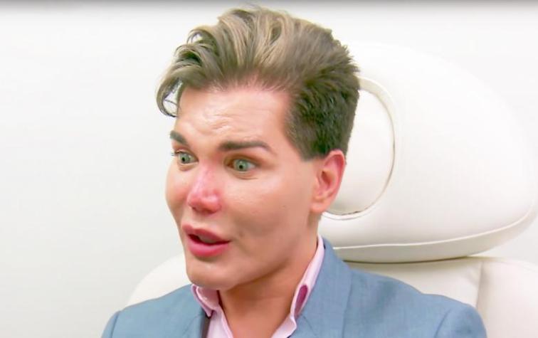 "Ken Humano" muestra las costillas que le quitaron y sus seguidores exigen que elimine la foto