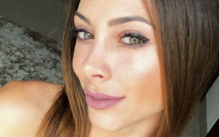 Esposa de Eduardo Vargas aclara supuesta intervención en el rostro