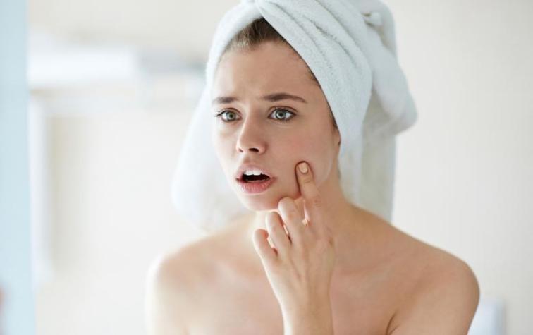 ¿Cómo cuido mi piel?: Cuatro problemas y cómo combatirlos sin ir a la farmacia