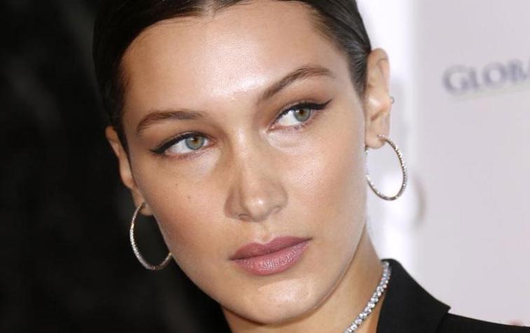 Medios estadounidenses comparan rostro de Bella Hadid ahora y hace años