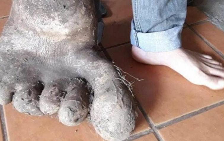 "Nunca vimos algo así": la foto del "pie de papa" que causa sensación en Internet