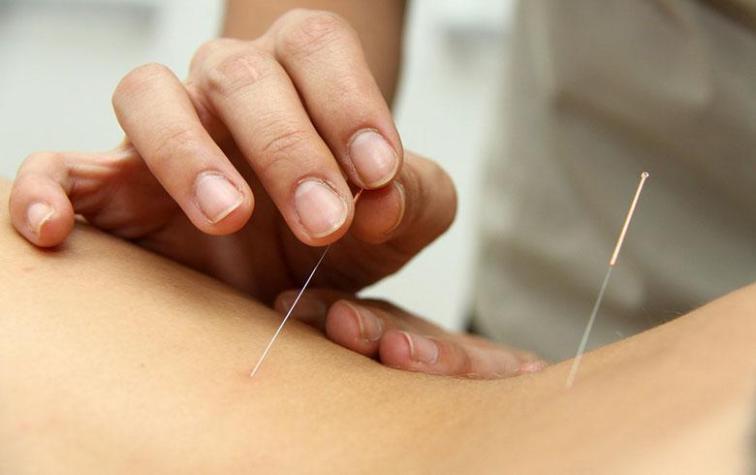 Probé la medicina China para tratar el estrés y la angustia y me ayudaron a sentir mejor