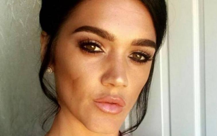 Cirujanos piden prohibición de peligrosa cirugía brasileña: ya han muerto dos mujeres