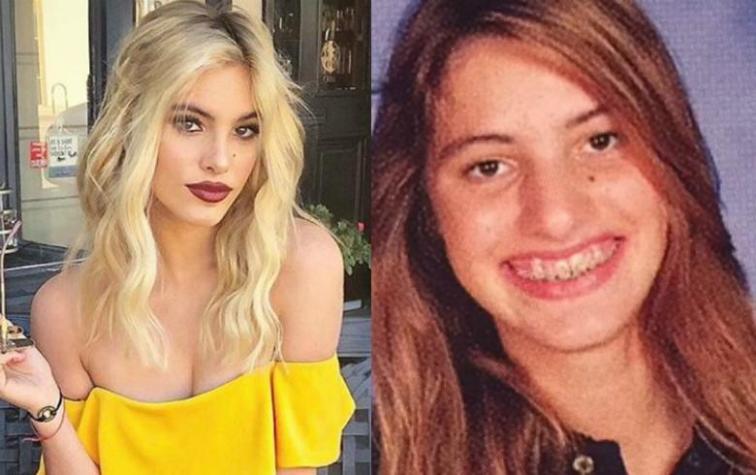 Lele Pons asegura que solo se ha hecho una cirugía en toda su vida