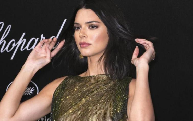 Kendall Jenner publica fotos con la cara llena de acné y revela que fue víctima de bullying
