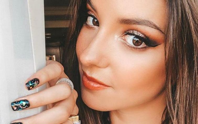 Kel Calderón presume su glamurosa bota ortopédica tras accidente