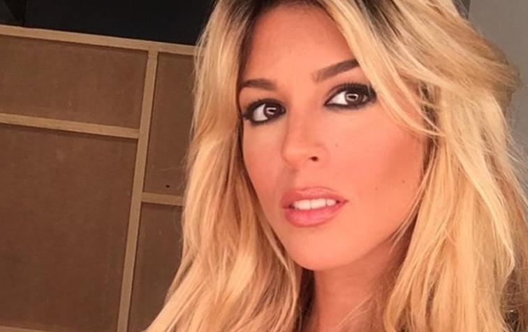 Usuarios critican a Oriana Marzoli por supuesto aumento de labios