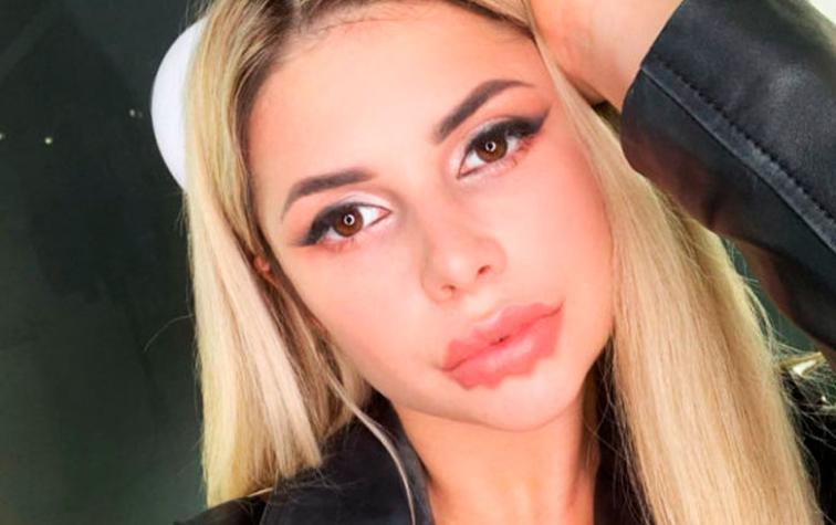 Labios de Diablo: Extraña tendencia de belleza causa revuelo en redes sociales