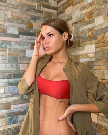 Gala Caldirola publica impactante foto del accidente que sufrió en 2012