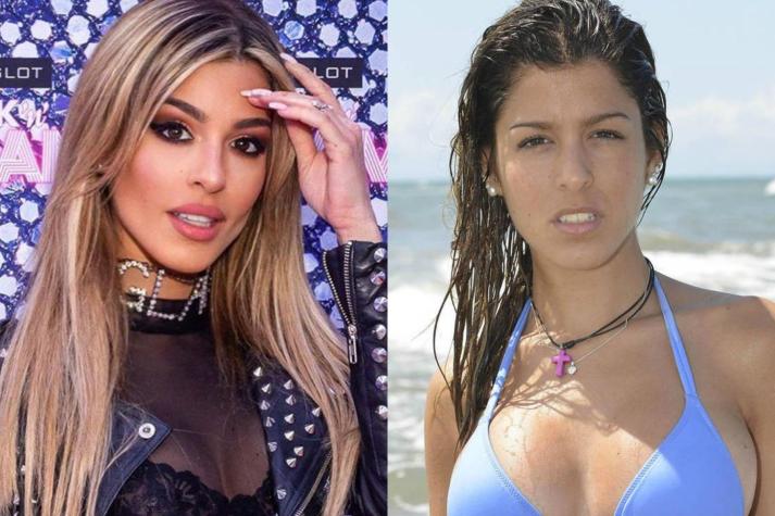 Oriana Marzoli: Cirujano analiza "operaciones" y le pone precio a su cambio de imagen