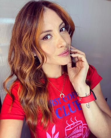 Karen Bejarano criticada por supuesto bótox en su rostro