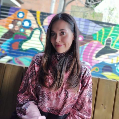 Vale Roth comparte los resultados del bótox en su rostro