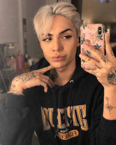 Así quedó Leo Méndez Jr. tras aumentar el tamaño de sus labios