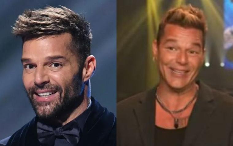 Ricky Martin luce irreconocible tras supuesto retoque en su rostro
