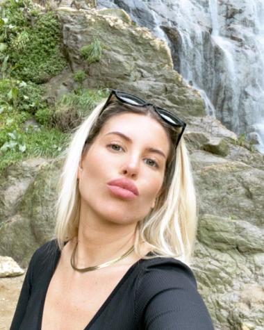 Cote López muestra resultados de procedimiento en sus labios