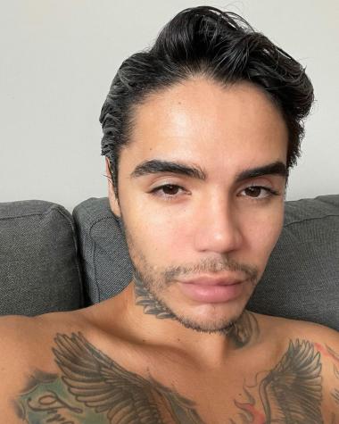 Leo Méndez Jr. revela las secuelas que le dejó operación en su rostro