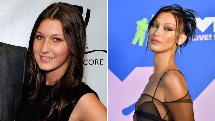 Bella Hadid admite cirugías y explica razón: "Era la hermana más fea"