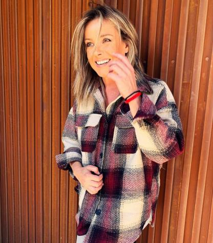 Claudia Conserva muestra cómo quedó tras insólito accidente