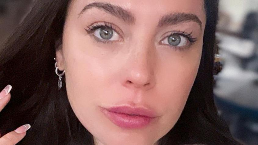 Daniela Aránguiz se sometió a nuevo procedimiento estético en su rostro