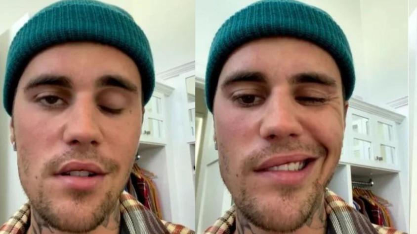 Síndrome de Ramsay Hunt: qué pasa con la salud de Justin Bieber