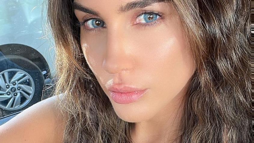 "El día es noche": Fran Undurraga comparte llamativo poema 