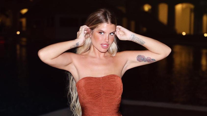 "Exagerada": Coté López saca risas con extraña metáfora