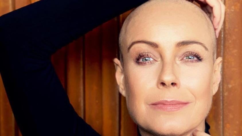 Claudia Conserva cuenta por qué documentó su lucha contra el cáncer