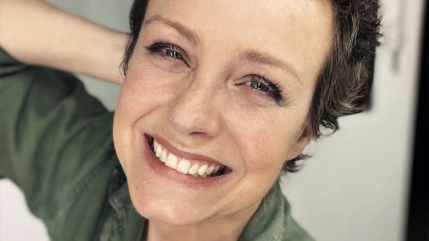 "Sigue lucrando con el cáncer": Claudia Conserva es víctima de desubicados comentarios tras procedimiento estético