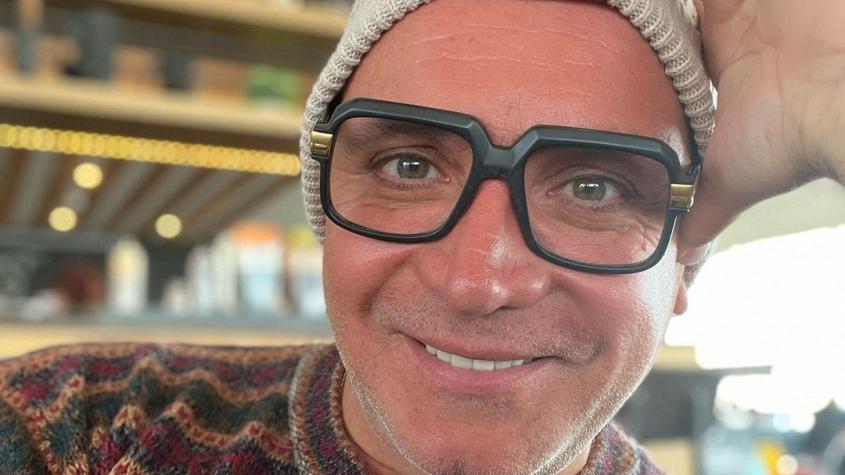 "No es tan caro": Luis Jara responde a cuestionamientos por uso de botox 