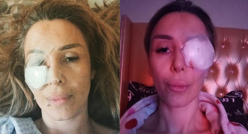 El drama de Romina Sáez tras brutal golpiza de arrendatario: “Mi cara no volverá a estar igual”