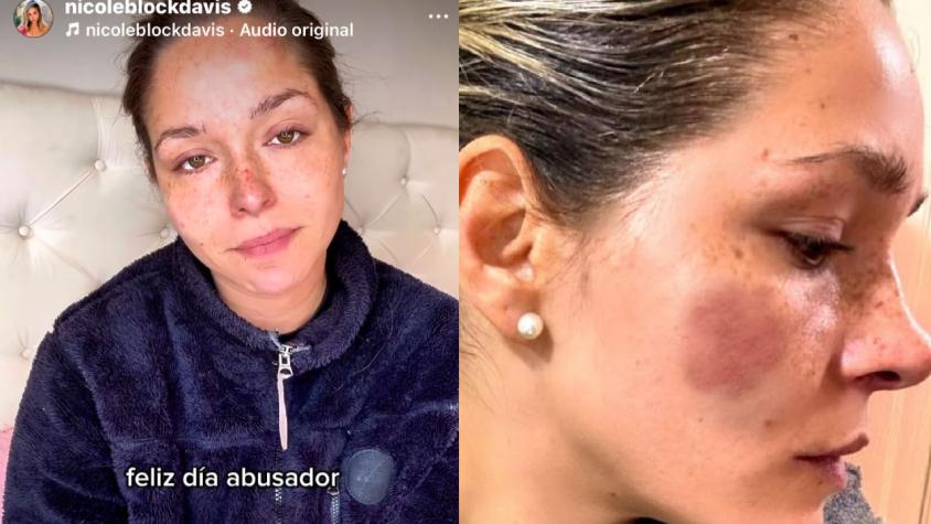 El desgarrador descargo de Nicole Block contra su padre: “Feliz día abusador”