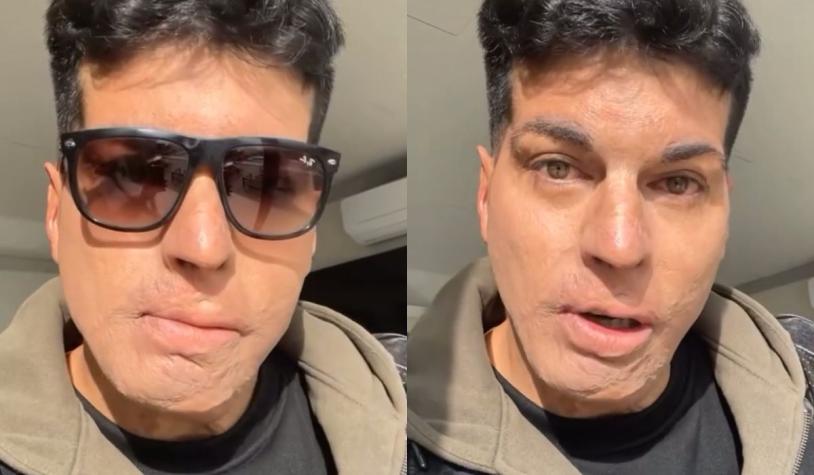 Ignacio Lastra se defiende tras fuerte relato de Julia Fernandes por accidente automovilístico en 2017