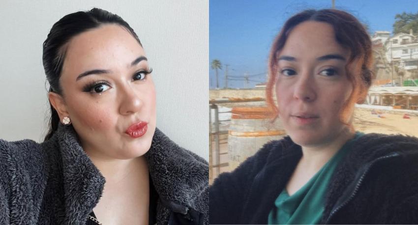 Christell Rodríguez confiesa que se sometió a intervención quirúrgica para perder peso: “Me hice una…”
