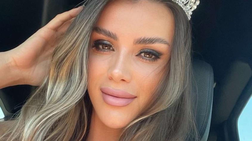 Ex Miss Kosovo, Güler Erdogan