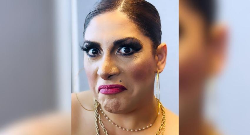 El antes y después de Botota Fox: así luce a dos meses de someterse a una Lipo Vaser