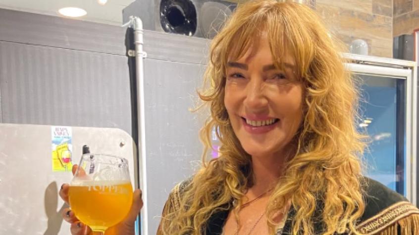 "Cada vez se está viendo más joven": Catalina Pulido mostró el antes y el después tras intervención estética en su rostro