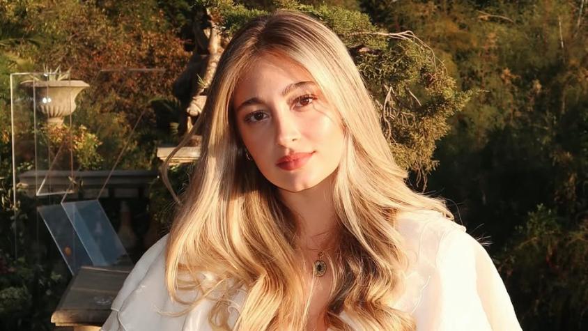 “No suelo mostrarlo”: Florencia Araneda expone afección médica que afecta su piel