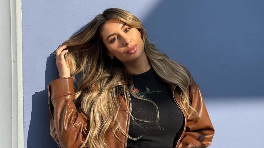 Camila Andrade reveló dura experiencia con cirugía plástica y acusó negligencia médica: "Durante cinco años mantuve un dolor"