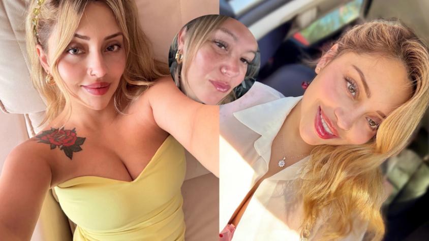 Katerin Salas acusó a Natalia Casas-Cordero de hostigamiento - Cedidas