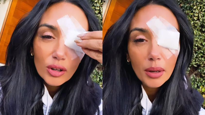 Pamela Díaz contó delicada situación que la dejó con parche en el ojo: se sometió a intervención médica