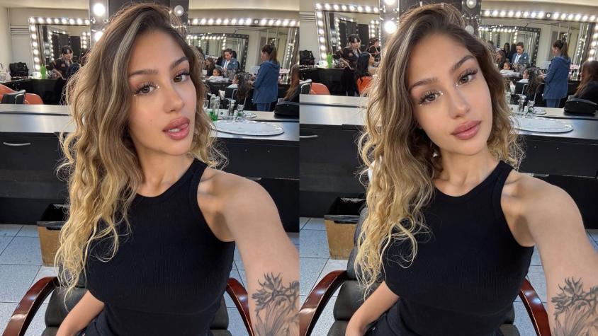 Trini Neira se sometió a novedoso tratamiento estético: influencer de 23 años mostró el antes y después